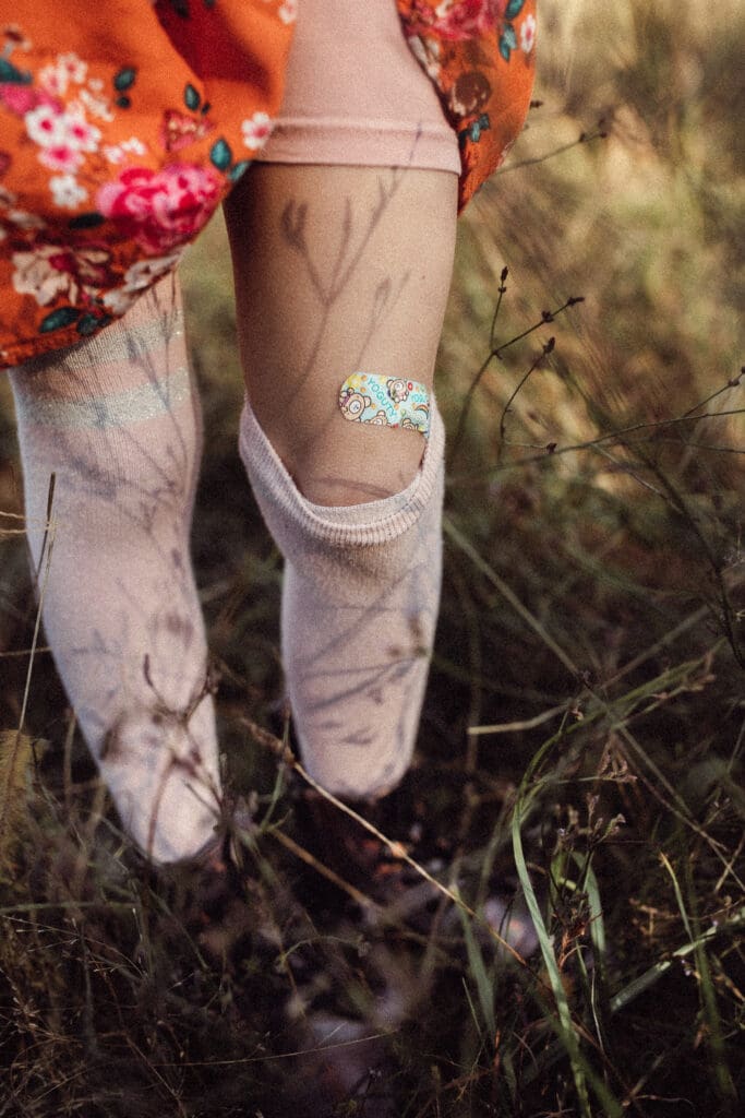detail shot of a young girl in tall grass. she's wearing knee high socks, ankle boots and a bright orange dress. She's lifting the dress a bit to show the photographer the band aid on her knee- one adorned with some sort of cartoon character. The son is bright and casting shadows from the tall grass onto her goosebump and band-aid covered leg.